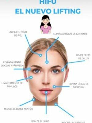 Ultralifting facial: rejuvenece tu rostro sin cirugía